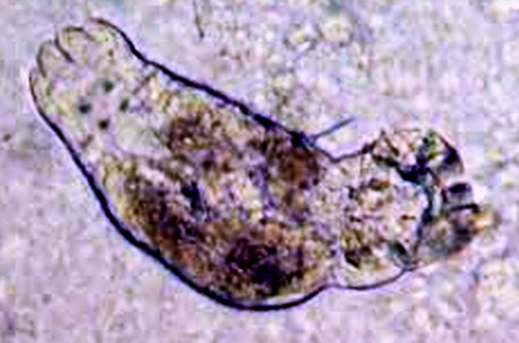 Flukes (Trematoda) Tropical Fish Keeping